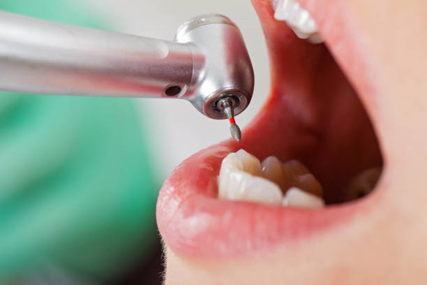 Best Dentist for Tooth Abscess  in Hibbing, MN